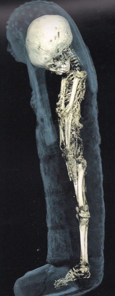 Mummy skeleton